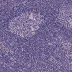 Immunohistochemical staining of human lymph node shows no positivity in non-germinal center cells as expected.