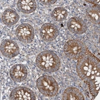 Anti-ANKRD26 Antibody