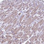 Immunohistochemical staining of human Heart muscle shows moderate granular cytoplasmic positivity in cardiomyocytes.
