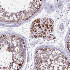 Immunohistochemical staining of human Testis shows strong granular cytoplasmic positivity in Leydig cells.