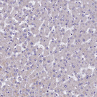 Immunohistochemical staining of human Liver shows very weak granular cytoplasmic positivity in hepatocytes.