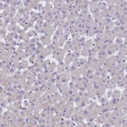 Immunohistochemical staining of human Liver shows very weak granular cytoplasmic positivity in hepatocytes.