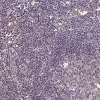 Anti-NUDT8 Antibody