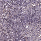 Immunohistochemical staining of human lymph node shows low expression as expected.