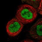 Immunofluorescent staining of human cell line A-431 shows localization to nucleoplasm.