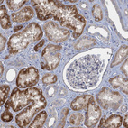 Immunohistochemical staining of human kidney shows moderate to strong cytoplasmic positivity in cells in tubules.