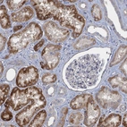 Immunohistochemical staining of human kidney shows moderate to strong cytoplasmic positivity in cells in tubules.