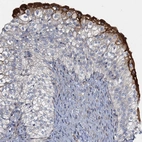 Immunohistochemical staining of human urinary bladder shows strong cytoplasmic positivity in urothelial cells.