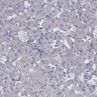 Immunohistochemical staining of human liver shows no positivity in hepatocytes as expected.