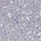 Immunohistochemical staining of human liver shows no positivity in hepatocytes as expected.