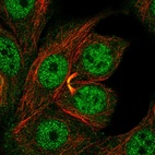 Immunofluorescent staining of human cell line MCF7 shows localization to nucleoplasm & cytokinetic bridge.