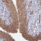 Anti-TELO2 Antibody