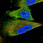 Immunofluorescent staining of human cell line U-251 MG shows localization to nuclear bodies & cytosol.