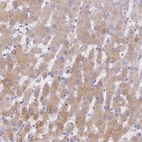 Anti-PZP Antibody