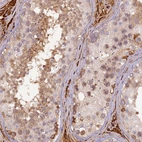 Immunohistochemical staining of human testis shows moderate cytoplasmic positivity in cells in seminiferous ducts.