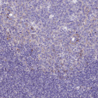 Immunohistochemical staining of human tonsil shows no positivity in non-germinal center cells as expected.