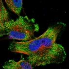 Immunofluorescent staining of human cell line U-251 MG shows localization to plasma membrane & cytosol.