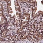 Immunohistochemical staining of human Small intestine shows moderate nuclear and cytoplasmic positivity in glandular cells.