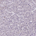 Immunohistochemical staining of human Liver shows very weak nuclear positivity in hepatocytes.
