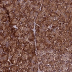 Anti-RBFA Antibody