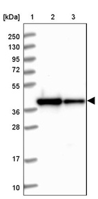 Lane 1: Marker [kDa] 250, 130, 95, 72, 55, 36, 28, 17, 10_br/_Lane 2: Human cell line RT-4_br/_Lane 3: Human cell line U-251MG sp