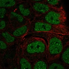 Anti-INO80 Antibody