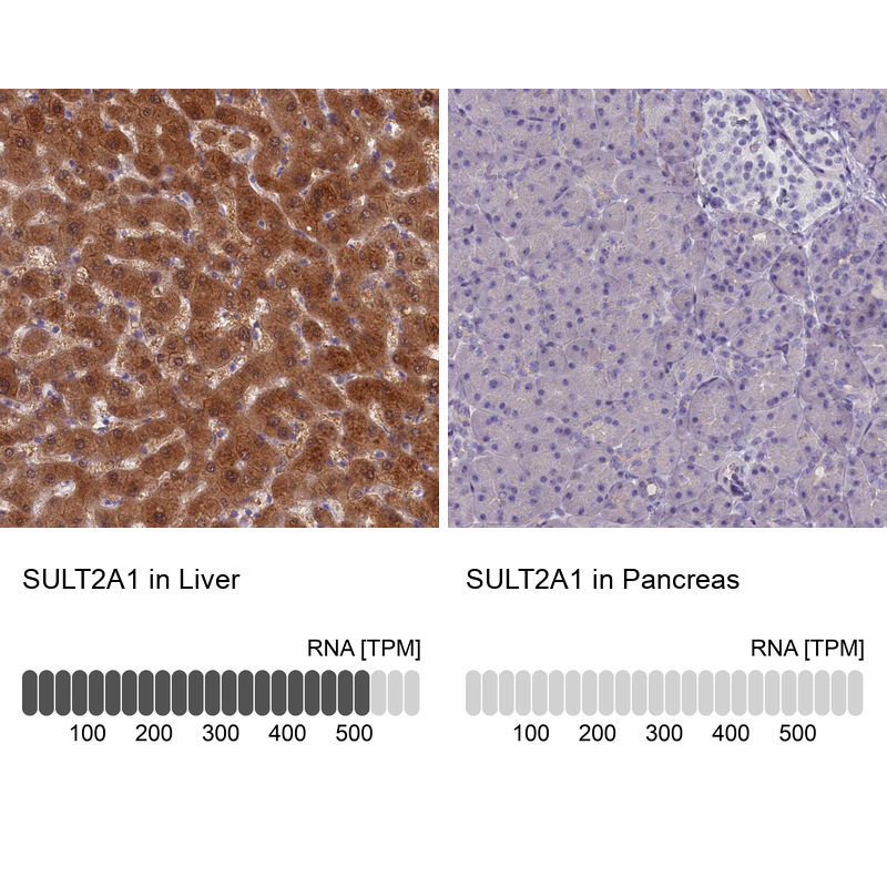 Anti-SULT2A1 Antibody