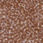 Immunohistochemical staining of human liver shows strong cytoplasmic positivity in hepatocytes.
