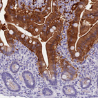 Immunohistochemical staining of human duodenum shows strong cytoplasmic positivity in glandular cells.
