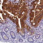 Immunohistochemical staining of human duodenum shows strong cytoplasmic positivity in glandular cells.