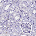 Immunohistochemical staining of human kidney shows no positivity in cells in tubules as expected.