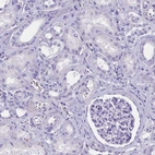 Immunohistochemical staining of human kidney shows no positivity in cells in tubules as expected.