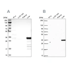 Western blot analysis using Anti-SULT2A1 antibody HPA041487 (A) shows similar pattern to independent antibody HPA063633 (B).