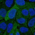 Immunofluorescent staining of human cell line RT4 shows localization to cytosol.
