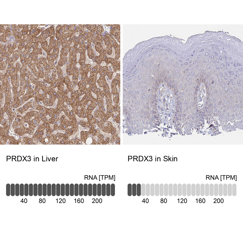 Anti-PRDX3 Antibody
