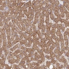 Immunohistochemical staining of human liver shows strong cytoplasmic granular positivity in hepatocytes.