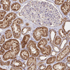 Immunohistochemical staining of human kidney shows strong cytoplasmic granular positivity in cells in tubules.