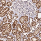Immunohistochemical staining of human kidney shows strong cytoplasmic granular positivity in cells in tubules.