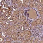 Anti-ATP10A Antibody