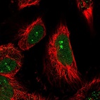 Immunofluorescent staining of human cell line U-251 MG shows localization to nucleus & nucleoli.
