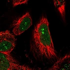 Immunofluorescent staining of human cell line U-251 MG shows localization to nucleus & nucleoli.