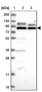 Lane 1: Marker [kDa] 250, 130, 95, 72, 55, 36, 28, 17, 10_br/_Lane 2: Human cell line RT-4_br/_Lane 3: Human cell line U-251MG sp