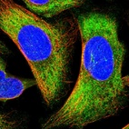 Immunofluorescent staining of human cell line U-2 OS shows localization to cytosol.