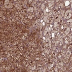 Anti-FAM96B Antibody
