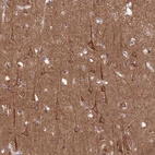 Immunohistochemical staining of human cerebral cortex shows strong cytoplasmic positivity in neurons and neuropil.