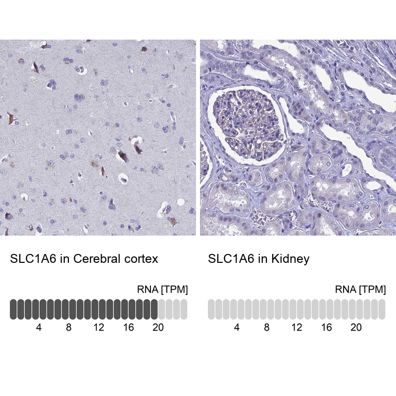 Anti-SLC1A6 Antibody