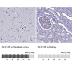 Anti-SLC1A6 Antibody