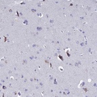 Immunohistochemical staining of human cerebral cortex shows high expression.