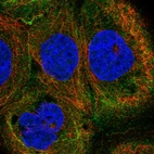 Immunofluorescent staining of human cell line A-431 shows localization to intermediate filaments.