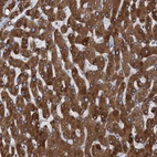 Immunohistochemical staining of human liver shows strong cytoplasmic positivity in hepatocytes.